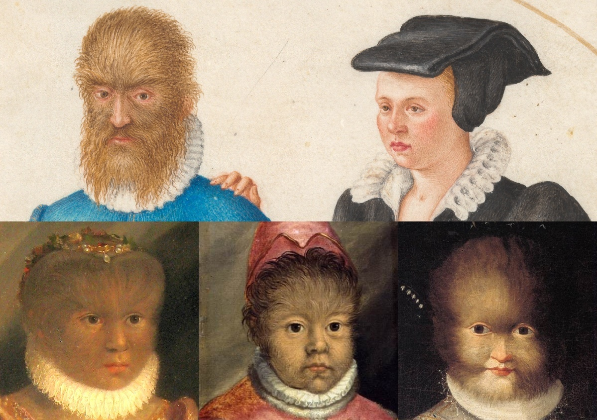 20250816-Cell-陈婷-1.世界上首次有记录的先天性全身多毛症患者Petrus Gonsalvus（1537-1618）及其妻子（上排）和子女（下排）。.png